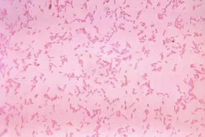 Study: We're losing the war against drug-resistant infections faster than we thought