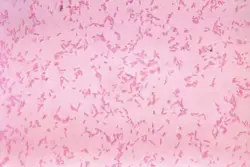 Study: We're losing the war against drug-resistant infections faster than we thought